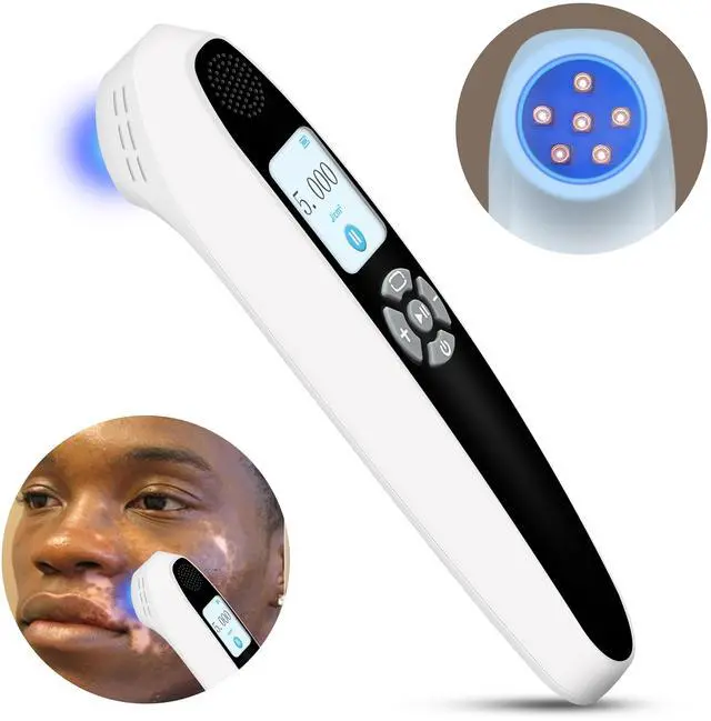 Main image of Toponechoice narrow band uv b light for vitiligo remedy for white patches on skin, white blemish on face