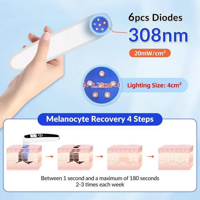 Alt view image 6 of 7 - Toponechoice home narrow band uvb light therapy for vitiligo, white spots on teeth reddit, back of throat white spots
