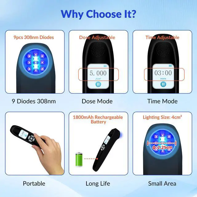 Alt view image 2 of 7 - Toponechoice uv light treatment near me for white spots on skin after sun, on legs
