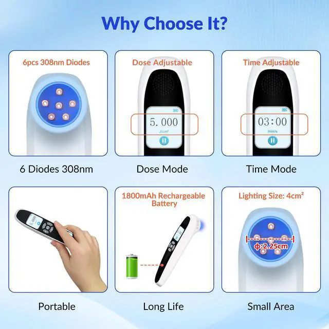 Alt view image 4 of 7 - Toponechoice uv light for skin treatment, cure for white spots on face, white patches in groin area female