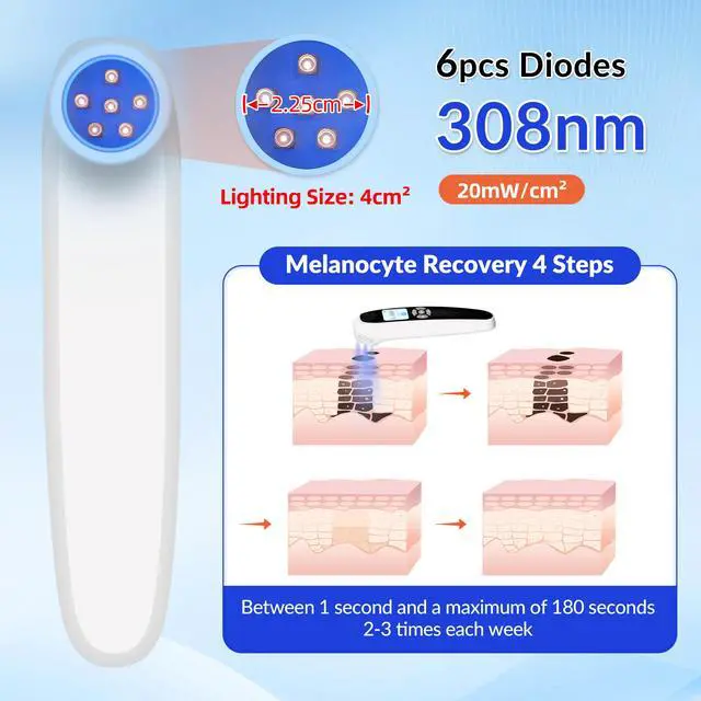 Alt view image 5 of 7 - Toponechoice dermatologist uv treatment for vitiligo white discoloration on nails, white patches at back of throat