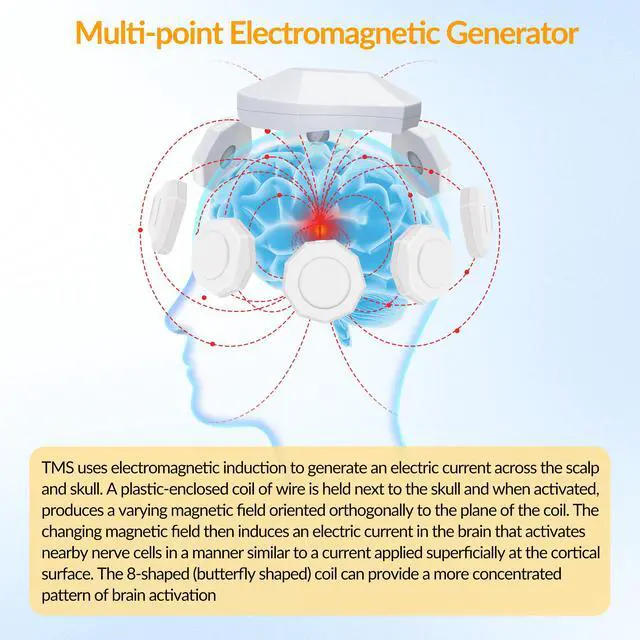 Alt view image 2 of 7 - Toponechoice brain stimulation device for depression and anxiety parksino OCD Cognitive Decline insomnia