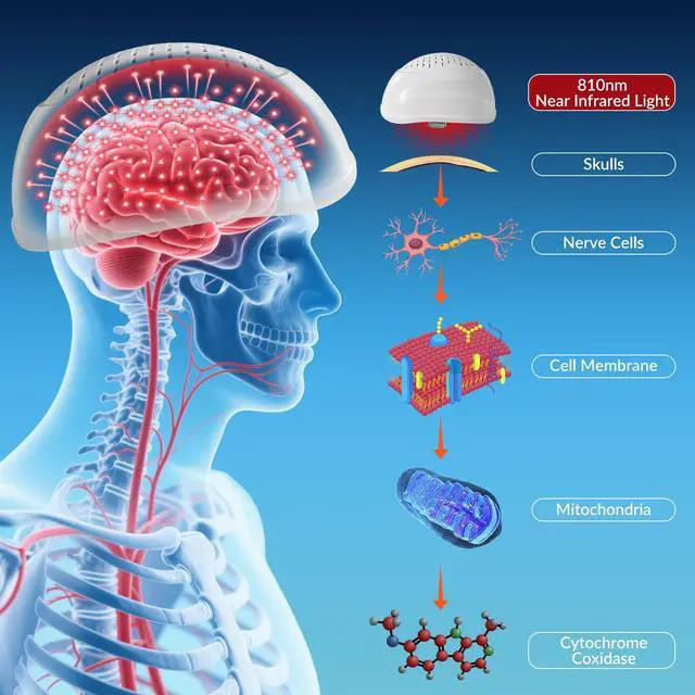 Alt view image 3 of 7 - Toponechoice red light helmet transcranial photobiomodulation treatment for cva multiple sclerosis ognitive disorder