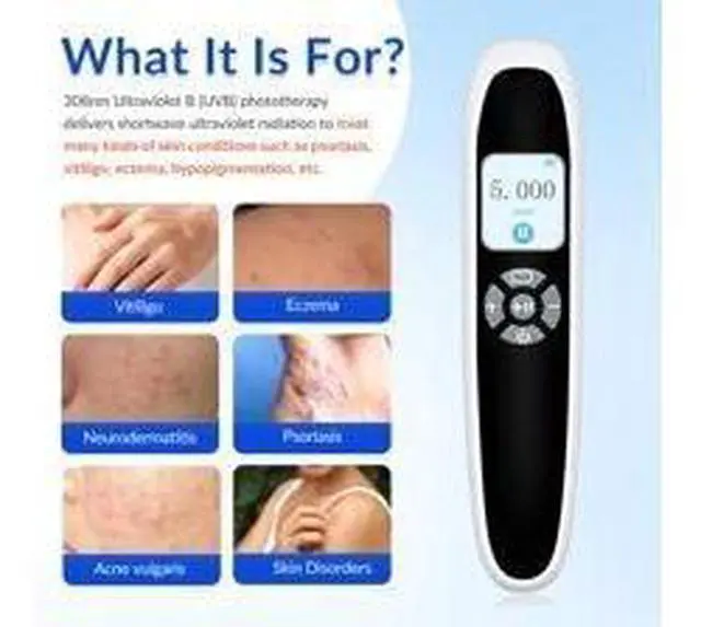 Alt view image 3 of 7 - ZJZK Excimer 308nm Laser Ultraviolet Handheld for Vitiligo, psoriasis
