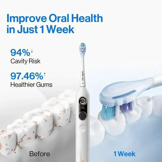 Alt view image 3 of 7 - Y10 PRO Rechargeable Electric Toothbrush with Smart Display, Missed Spot Detection, Pressure Sensor, 180-Day Battery Life, IPX8 Waterproof, Travel-Friendly with 2 Brush Heads