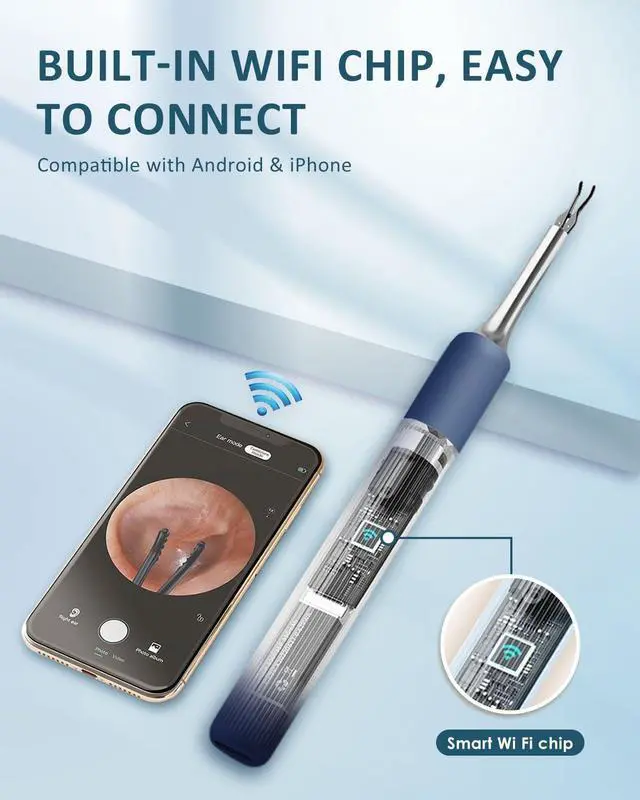 Alt view image 5 of 7 - CozyZen S5 Smart Visual Ear Cleaner with 10MP Camera & 1080P HD - Earwax Removal Tool Kit: Omnidirectional Tweezers, Otoscope, 12 Silicone Tips (iOS/Android, Portable Case)