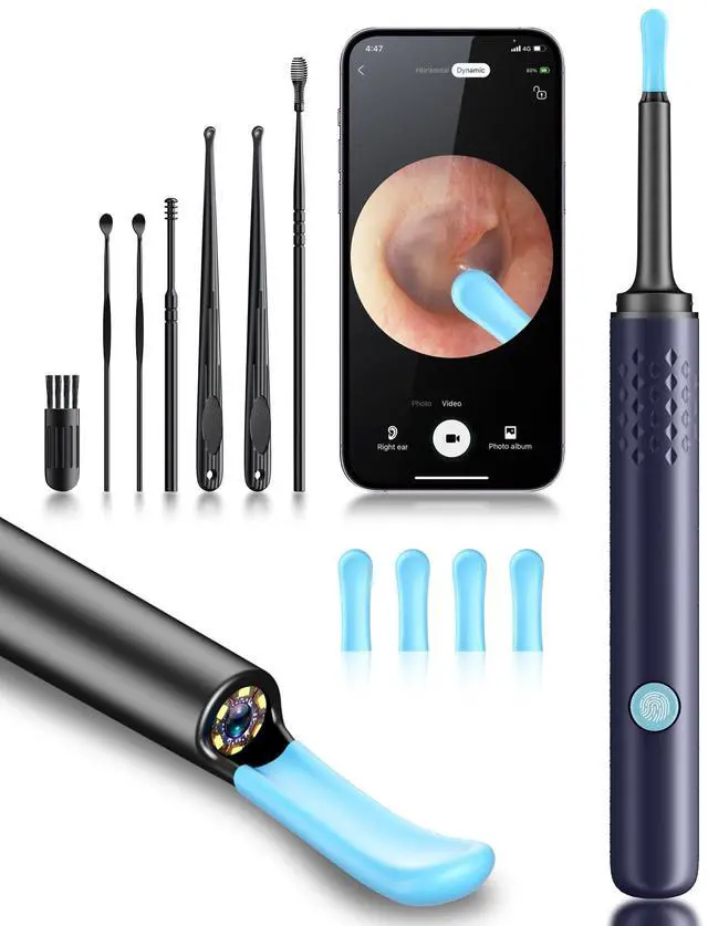 Main image of Ear Wax Removal Tool Camera - Ear Cleaner with Camera,1080P Otoscope, Ear Cleaning Tool with 4 Ear Spoon, Ear Camera for iPhone & Android Phones - Blue