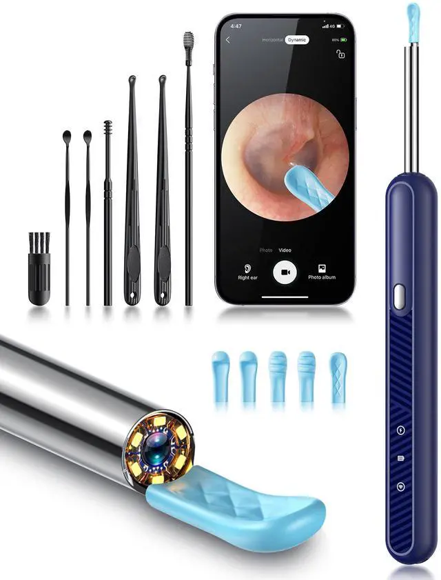 Main image of Loyker Ear Wax Removal Tool Camera, Ear Cleaner with 1080P Camera, Earwax Removal Cleaning Kit with 6 Ear Pick, Otoscope for iPhone, iPad, Android Phones, Blue