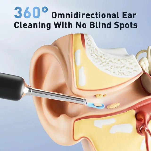 Alt view image 6 of 7 - Ear Wax Removal - Electric Ear Irrigation Flushing System with 4 Pressure Modes, Ear Cleaner with Camera, 1080P Otoscope, Ear Cleaning Tool with 7 Pcs Ear Set, Safe and Effective Earwax Removal Kit