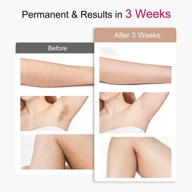 Alt view image 7 of 7 - IPL Laser Hair Removal for Women and Men with 5 Sapphire Ice-Cooling, Nearly Painless & Long-Lasting Results Hair Removal Device,5 Levels & 2 Modes, 98% Hair Reduction for Fast Full Body From Home