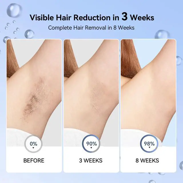 Alt view image 3 of 7 - Laser Hair Removal for Women, IPL Laser Hair Removal Device, Painless Hair Remover at Home with Sapphire Ice-Cooling, Long-Lasting Hair Reduction in 3 Weeks for Face Body Bikini, Gifts for Women Her
