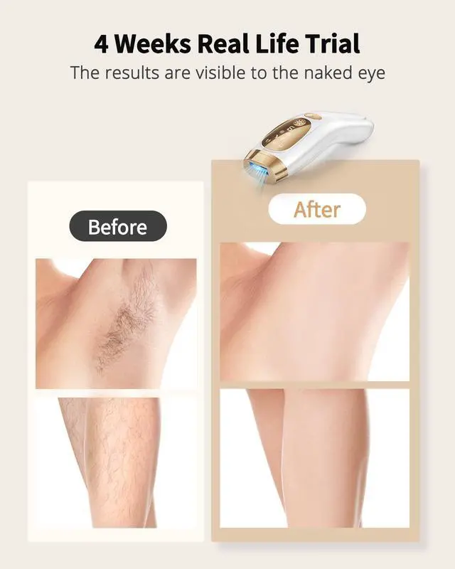 Alt view image 2 of 7 - UENMOON Laser Hair Removal for Women and Men - IPL Hair Removal with Ice-Cooling System for Painless & Long-Lasting Result, Whole Body Hair Removal