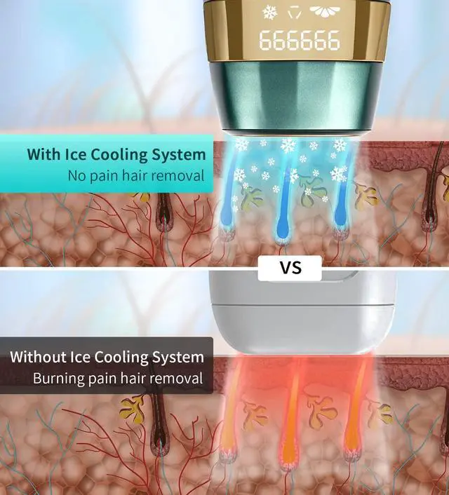 Alt view image 2 of 5 - Laser Hair Removal for Women and Men : New Upgraded at Home Use IPL Hair Removal Device Permanent & Protection - 5 Levels Laser Hair Removal for Face Legs Arms and Whole Body Green