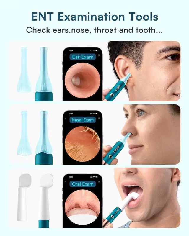 Alt view image 7 of 7 - Bebird Earsight Ultra Ear Wax Removal Kit,2K HD Visual Ear Cleaner with Camera,FSA/HSA Eligible Flexible Ear Camera with 90-Minute Battery & Enhanced Light,Ear Cleaning Tool for Adults & Kids