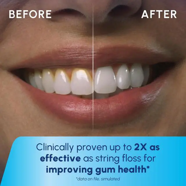 Alt view image 5 of 7 - Cordless Pulse Rechargeable Portable Water Flosser for Teeth, Gums, Braces Care and Travel with 2 Flossing Tips, Waterproof for Shower, ADA Accepted, WF-20 White, Packaging and Tips May Vary