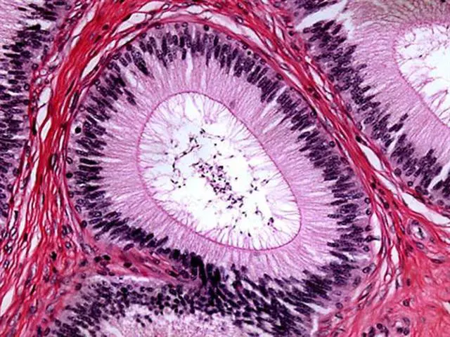 Alt view image 4 of 4 - M500-LED Cordless Monocular Compound Microscope, WF10x Eyepiece, 40x-1000x Magnification, Anti-Mold Optics, LED Illumination, Brightfield, Abbe Condenser, Coarse and Fine Focus, Plain Stage, 110V or B