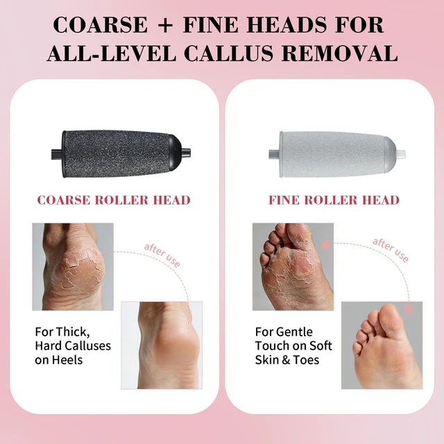 Alt view image 2 of 7 - Foot Callus Remover, Electric Callus Remover for Feet with Dual Roller Heads, 2 Speeds & LED Light, 3× Faster Than Manual, 90-Min Runtime, Pedicure Tools for Feet, Foot File for Home Use