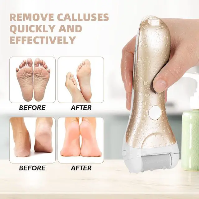 Alt view image 6 of 7 - Callus Remover for Feet, Electric Foot File Callus Removers Rechargeable Waterproof Pedicure Tools Foot Scrubber Shaver Feet Care Tool for Cracked Heels Dead Skin Golden