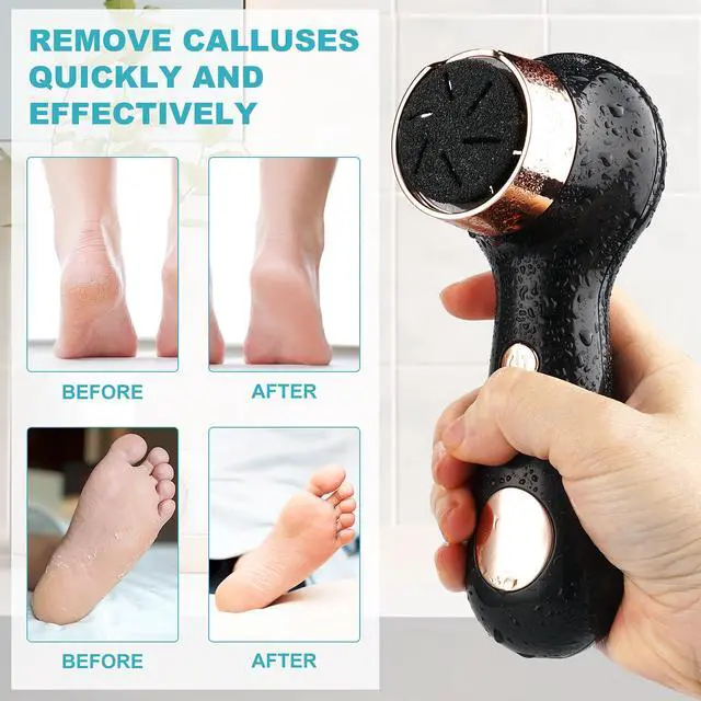 Alt view image 6 of 6 - Electric Foot Callus Removers for Feet - Rechargeable Waterproof Portable Electronic Foot File Pedicure Tools for Cracked Heels Dead Skin