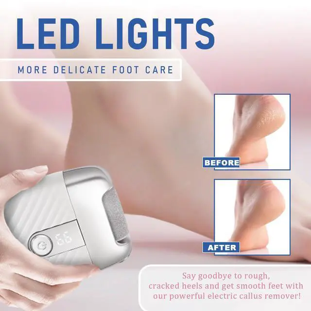 Alt view image 2 of 6 - Electric Foot File with 2 Speeds & LED Display, Rechargeable Callus Remover with 3 Grit Heads (Coarse/Medium/Fine), Pedicure Tools for Feet Hard Skin Smooth Polishing (White)