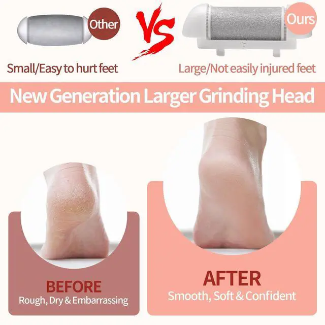 Alt view image 5 of 7 - Electric Foot Callus Remover, Rechargeable Electric Callus Remover for Feet with 3 Speed, 9 in 1 Pedicure Kit with Nano-Glass, Waterproof Professional Foot File for Dead, Hard, Cracked Skin(Pink)