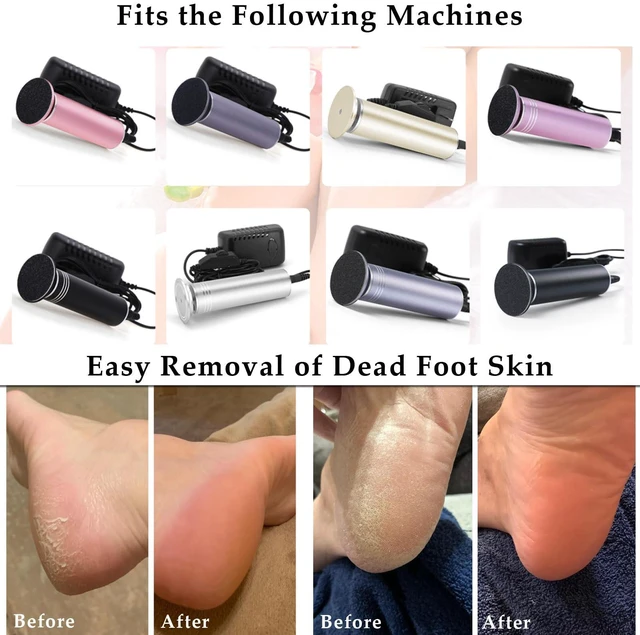 Alt view image 7 of 7 - 120pcs Foot File Sandpaper Discs Refill for Electric Callus Remover Dead Skin Removal (60pcs Rough 80 Grit + 60pcs Smooth 180 Grit)