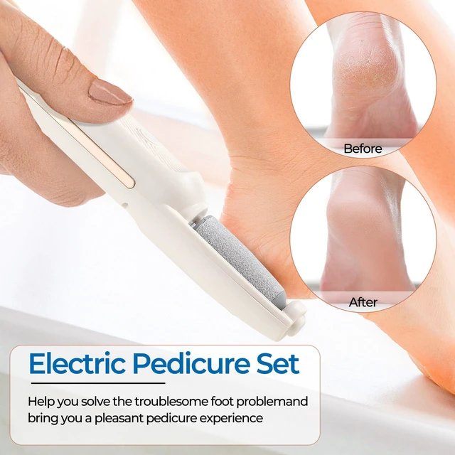 Alt view image 2 of 7 - Electric Callus Remover for Feet, Rechargeable Foot File for Dead Skin, Waterproof Pedicure Tool for Cracked Heels, Comes with 2 Interchangeable Roller Heads (Coarse & Fine)