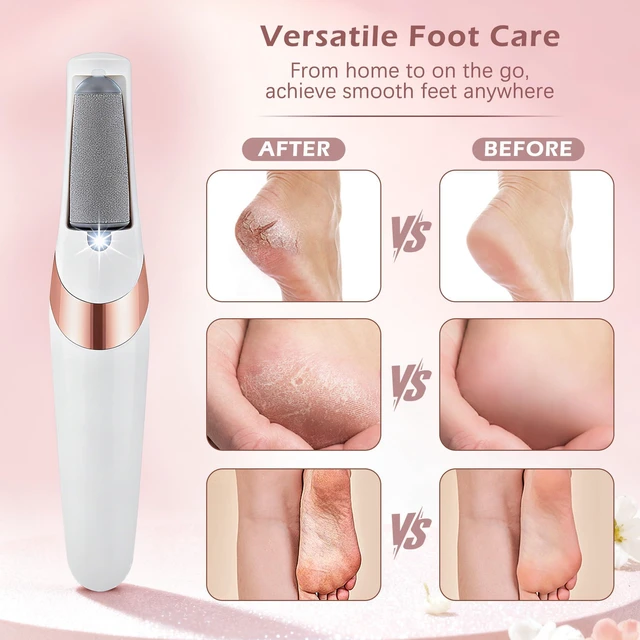 Alt view image 6 of 7 - Rechargeable Electric Callus Remover for Feet, Low-Noise Portable Foot File Callus Remover with 2 Replaceable Rollers, 2 Gears Foot Callus Remover for Smooth Heels at Home or Travel (White)
