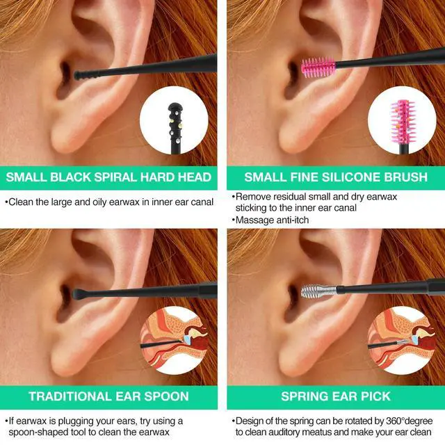 Alt view image 6 of 7 - Ear Vacuum Wax Remover, Earwax Removal Kit with 9 Levels Strong Suction