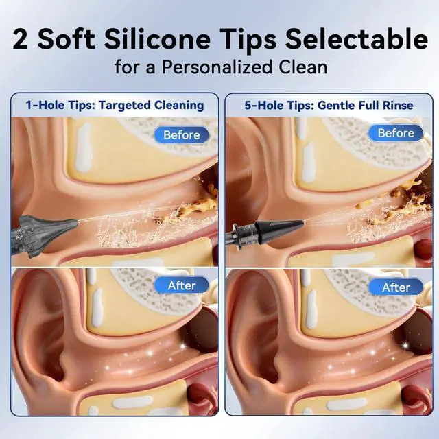 Alt view image 4 of 7 - Ear Wax Removal Kit Electric Ear Cleaner Irrigation System IPX7