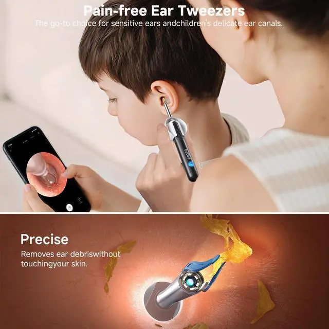 Alt view image 3 of 7 - R1 Ultra Ear Wax Remova, Ear Cleaner with Camera Ear Scope, Wax Remove Ear Pick with Ear Otoscope Tweezers, Visual Dropper Cleaning Kit, Ear/Nose/Throat Examination Tool for Family, Black