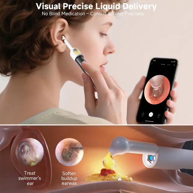Alt view image 4 of 7 - R1 Ultra Ear Wax Remova, Ear Cleaner with Camera Ear Scope, Wax Remove Ear Pick with Ear Otoscope Tweezers, Visual Dropper Cleaning Kit, Ear/Nose/Throat Examination Tool for Family, Black