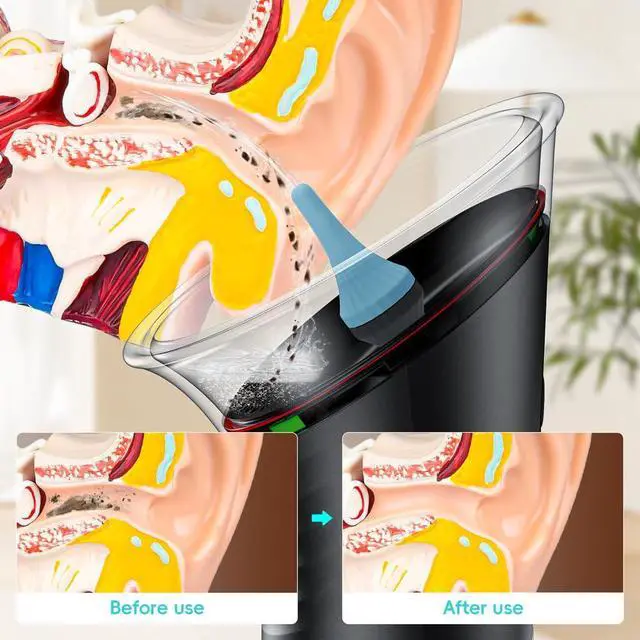 Alt view image 7 of 7 - Ear Wax Removal with LED Display, Electric Ear Cleaner, Rechargeable Earwax Remove Removal Ear Irrigation System, 3 Pressure Modes Ear Cleaning Earwax Removal (12 Disposable Tips)-Black