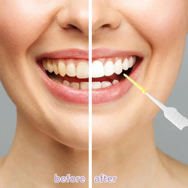 Alt view image 6 of 7 - 250 Interdental Brushes, Silicone Floss Picks With Case, Yellow/Purple