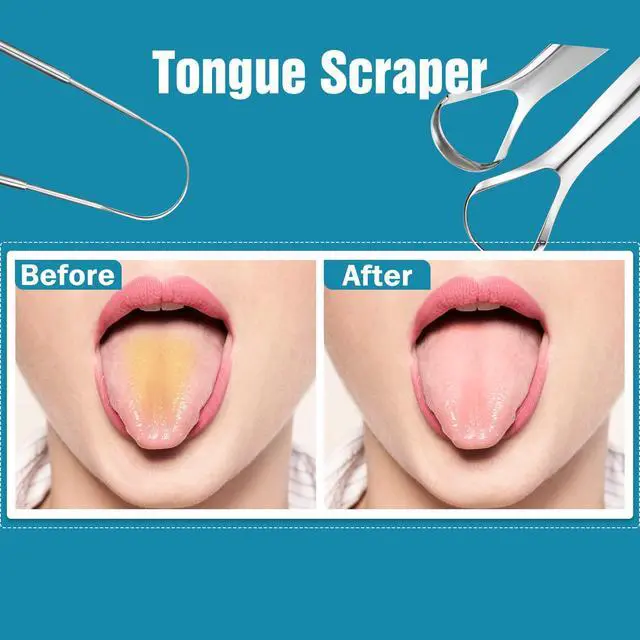 Alt view image 4 of 6 - 3 PCS Metal Tongue Scraper, Tongue Scrapers for Adults, Stainless Steel Tounge Scrappers, Tounge Scraper, Portable Tongue Scrappers