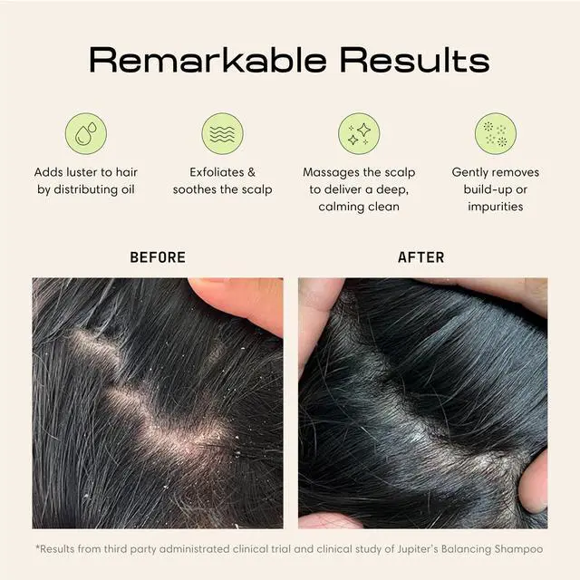 Alt view image 2 of 6 - Scalp Exfoliator - Scalp Massager Tool for Wet & Dry Hair - Ergonomic Detangler Brush - Dandruff Comb & Scrub to Remove Dandruff & Buildup and Support Circulation - Black/White