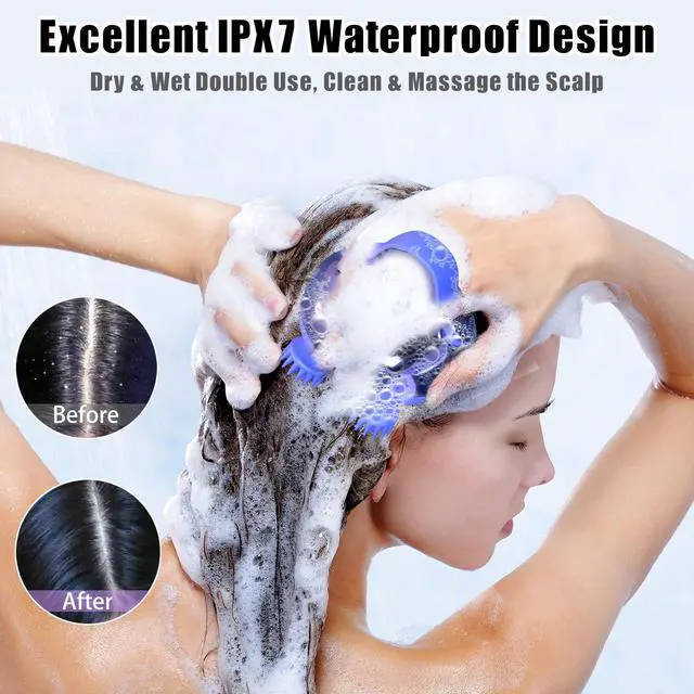 Alt view image 4 of 7 - Scalp Massager Electric, Portable Scalp Massager Tool, Waterproof Head Massage Stress Relax, Hair Massagers with 3 Speed Modes & 8 Massage Claws