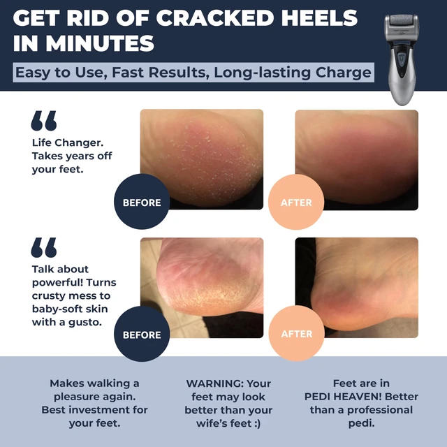 Alt view image 2 of 7 - Electric Foot Callus Remover - Rechargeable Pedicure File Tool | Rapid Callus Relief, Professional Foot Grinder, Cordless, 3 Rollers, Water-Resistant, for Cracked Heels, Dry, Hard, Dead Skin