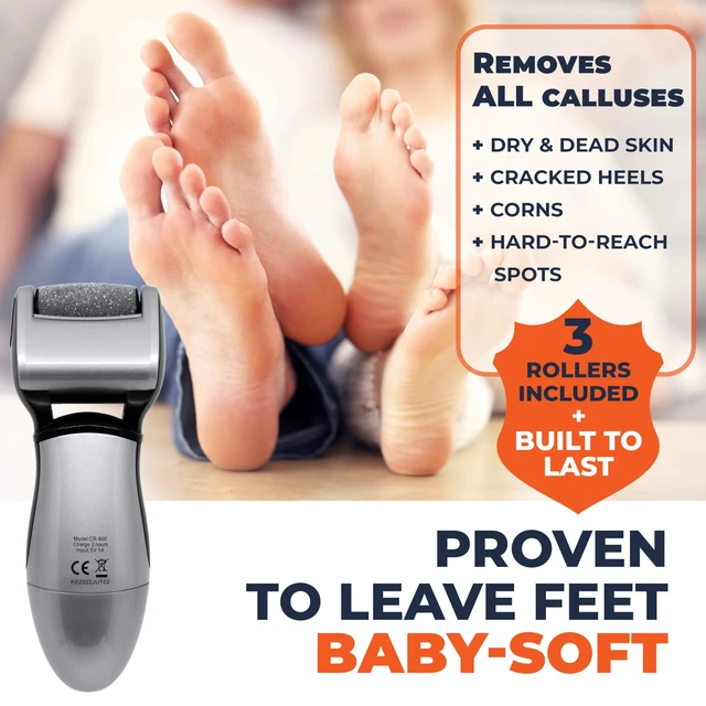 Alt view image 3 of 7 - Electric Foot Callus Remover - Rechargeable Pedicure File Tool | Rapid Callus Relief, Professional Foot Grinder, Cordless, 3 Rollers, Water-Resistant, for Cracked Heels, Dry, Hard, Dead Skin