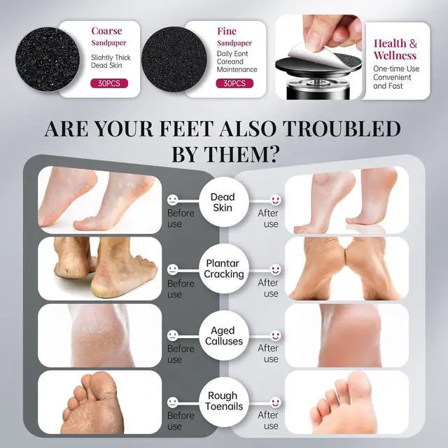 Alt view image 6 of 7 - 1000RPM Electric Callus Remover - Professional Aluminum Foot File Adjustable Pedicure Tool with 60pcs Sandpaper Discs for Dead Skin at Home