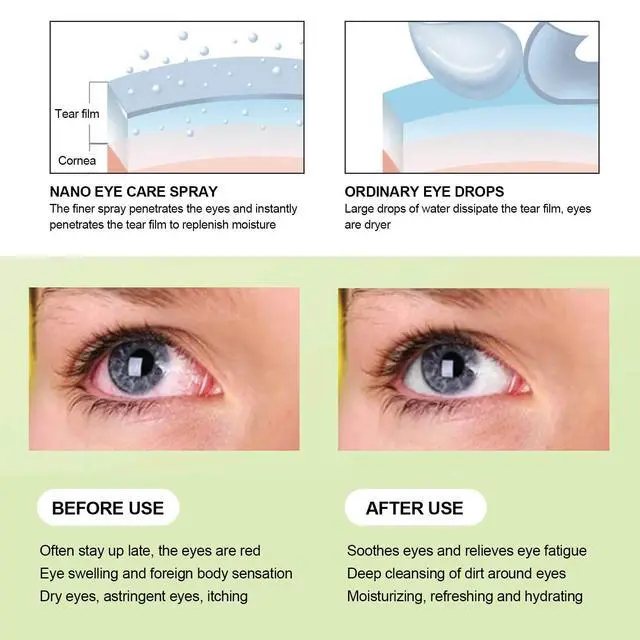 Alt view image 5 of 7 - Eye Moisturizing Machine, Skin Cleaning Eye Care Sprayer, for USB Charging Handheld(The New Eye moisturizer Blue)