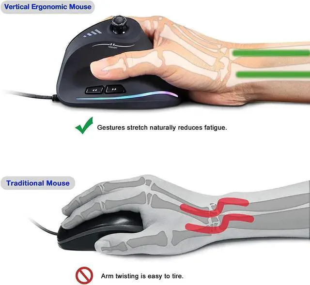 Alt view image 2 of 6 - TRELC Gaming Mouse with 5 D Rocker, Ergonomic Mouse with 10000 DPI/11 Programmable Buttons, RGB Vertical Gaming Mice Wired for PC/Laptop/E-Sports/Gamer (Black)