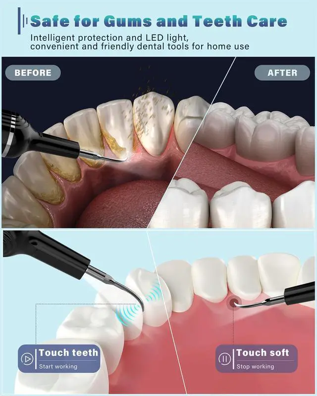 Alt view image 2 of 7 - Plaque Remover for Teeth, Dental Cleaning Kit Tartar Remover for Teeth with LED Light & 5 Modes, Rechargeable Dental Cleaner, 4 Replaceable Heads