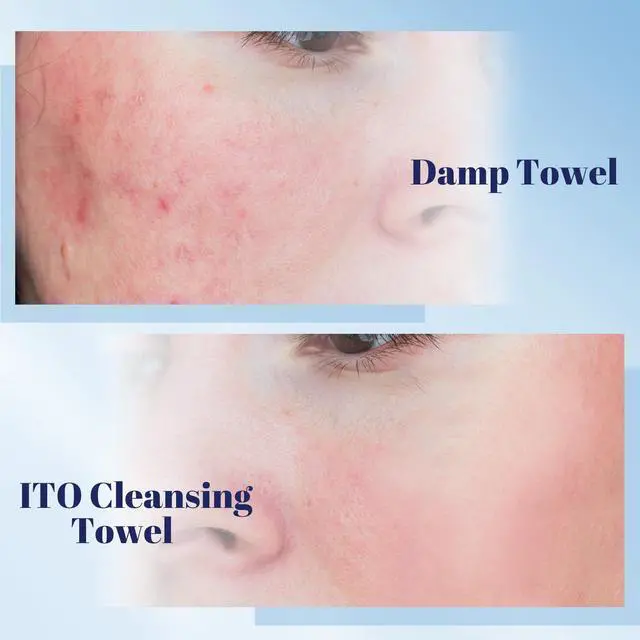 Alt view image 4 of 7 - Face Towels, Ultra-Soft & Extra Thick Cleansing Towels for Sensitive, Dry & Oily Skin, Facial Tissue, Makeup Remover Disposable Towels (60 Count (Pack of 1))