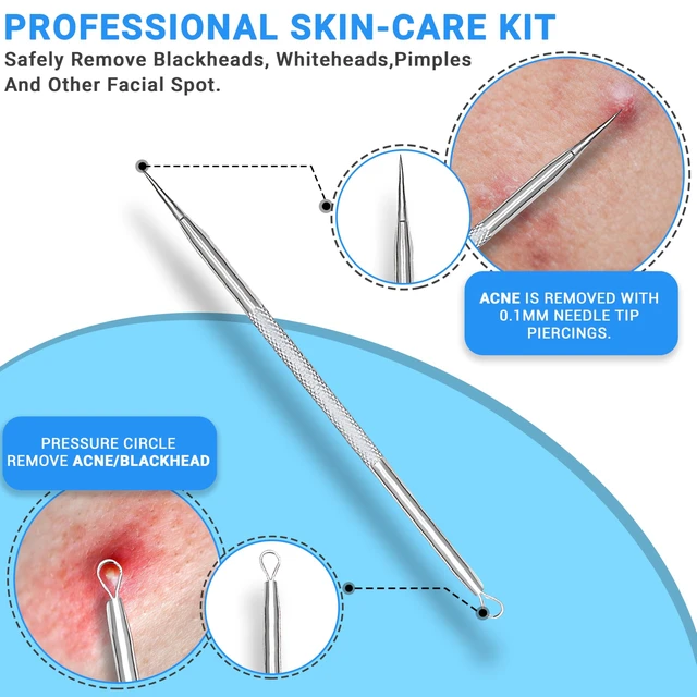 Alt view image 4 of 7 - 2Pcs Stainless Steel Surgical Pimple Extractor Blackhead Remover