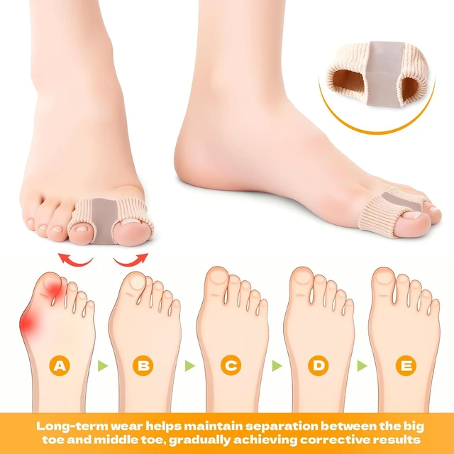 Alt view image 3 of 7 - 4 PCS Toe Spacers for Women and Men