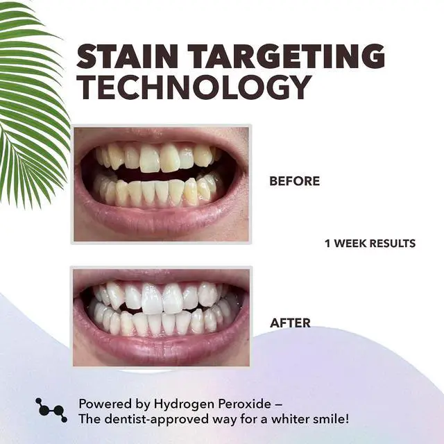 Alt view image 4 of 7 - 9Day Teeth Whitening Strips 18Count Dry Whitening Strips Infused Coconut Oil EnamelSafe NonSlip Whitener for Sensitive Teeth Remove Coffee Tea Wine Stains