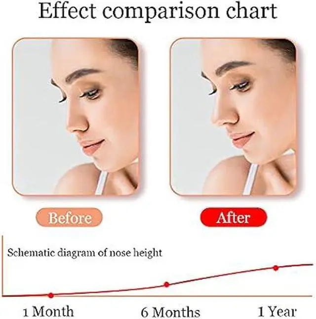 Alt view image 6 of 7 - Nose Shaper Lifter Clip, Safe Painless Nose Straightener Tool, Reusable Nose Bridge Lifting Slimming Corrector for Wide, Flat, Crooked Nose, Nose Reshaping Beauty Tool for Men Women