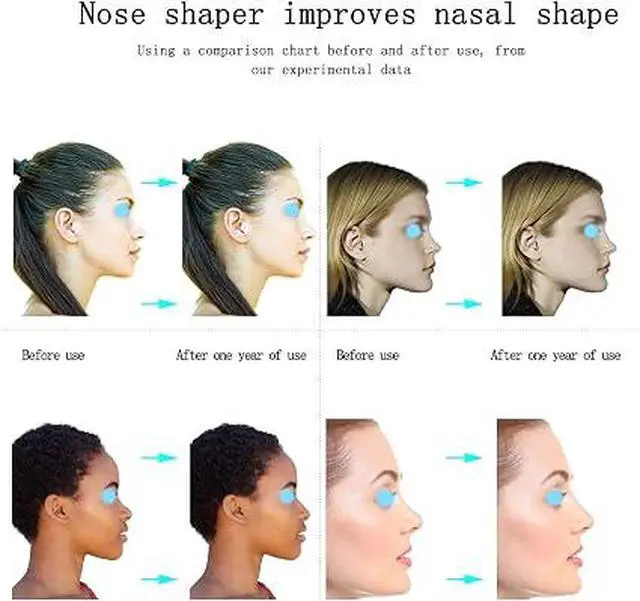Alt view image 3 of 7 - Nose Shaper Lifter Clip, Safe Painless Nose Straightener Tool, Reusable Nose Bridge Lifting Slimming Corrector for Wide, Flat, Crooked Nose, Nose Reshaping Beauty Tool for Men Women