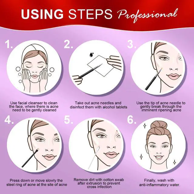 Alt view image 7 of 7 - Teenitor 2-in-1 Pimple Extractor Comedone and Acne Tool Blackhead Removal for Face and Nose Black